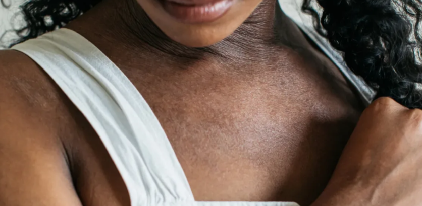 Clop G Cream [ একজিমা, দাগ চিকিৎসায় ]_img_4