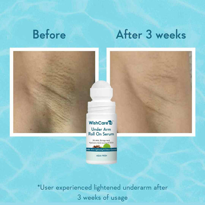 WishCare Underarm Roll On Serum - 5% AHA & 3% Kojic for Brightening & Odour Control - Roll On Deo for Women & Men- Long Lasting Aqua Fragrance - 50ml_img_1