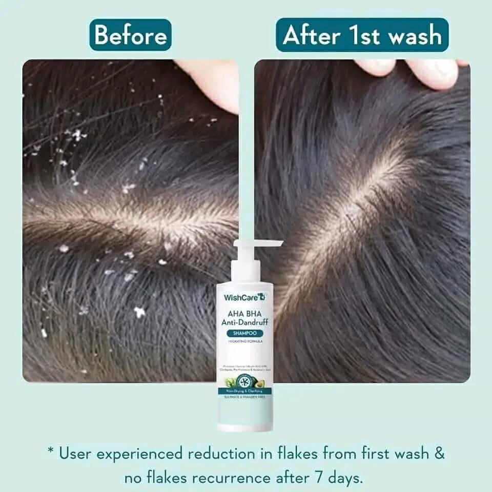 WishCare AHA BHA Anti-Dandruff Shampoo 250ml_img_1