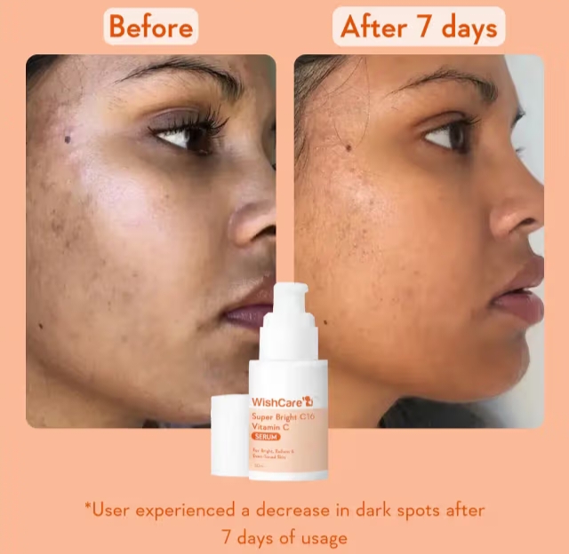 WishCare Super Bright C16 Vitamin C Serum 30ml_img_2