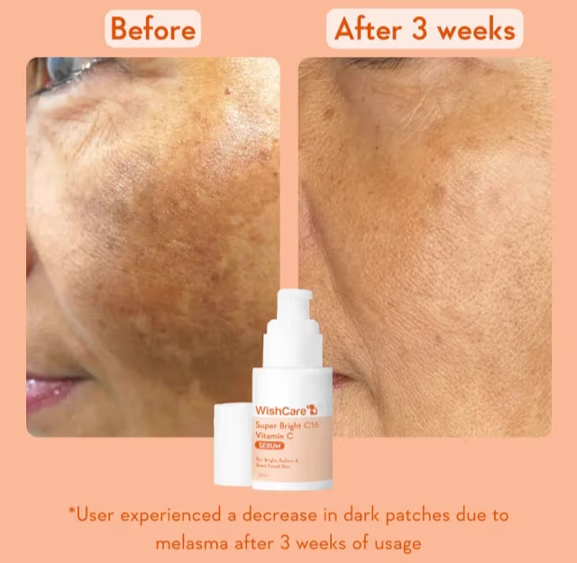 WishCare Super Bright C16 Vitamin C Serum 30ml_img_3