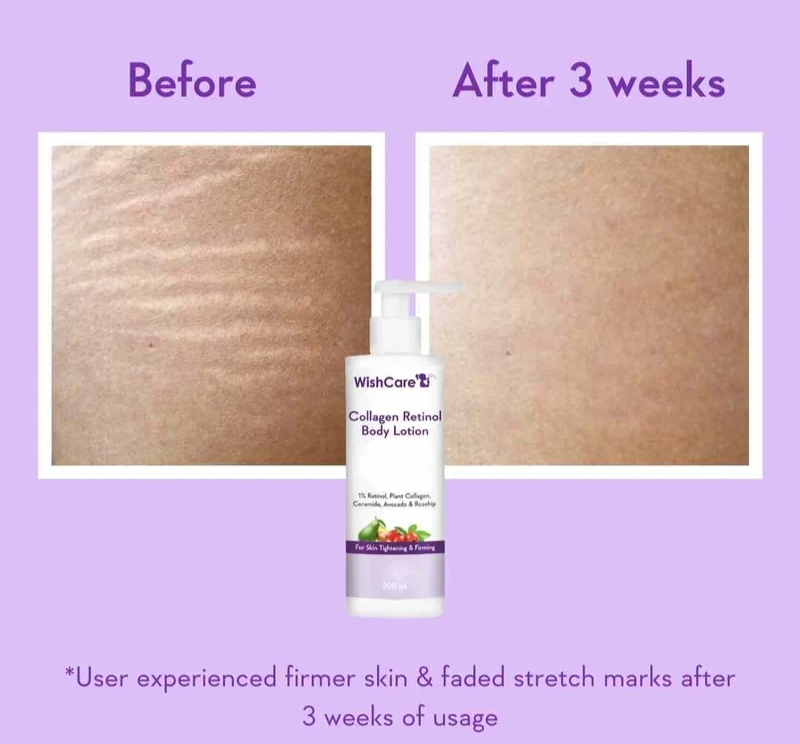 WishCare Collagen Retinol Body Lotion 200ml_img_4