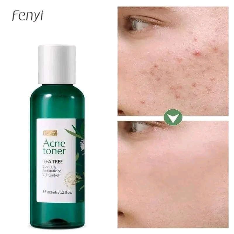 Fenyi Acne Toner Tea tree 100ml